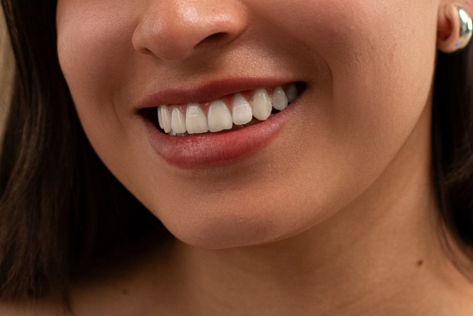 A Complete Guide to Portrait Retouching Workflow Teeth Whitening on Aftershoot