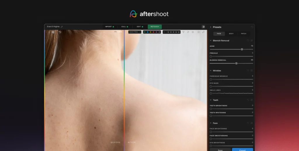 body blemish removal 1 5x