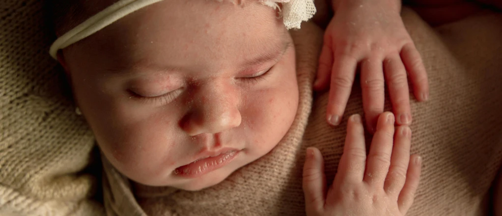 Blemish-Removal-before-1