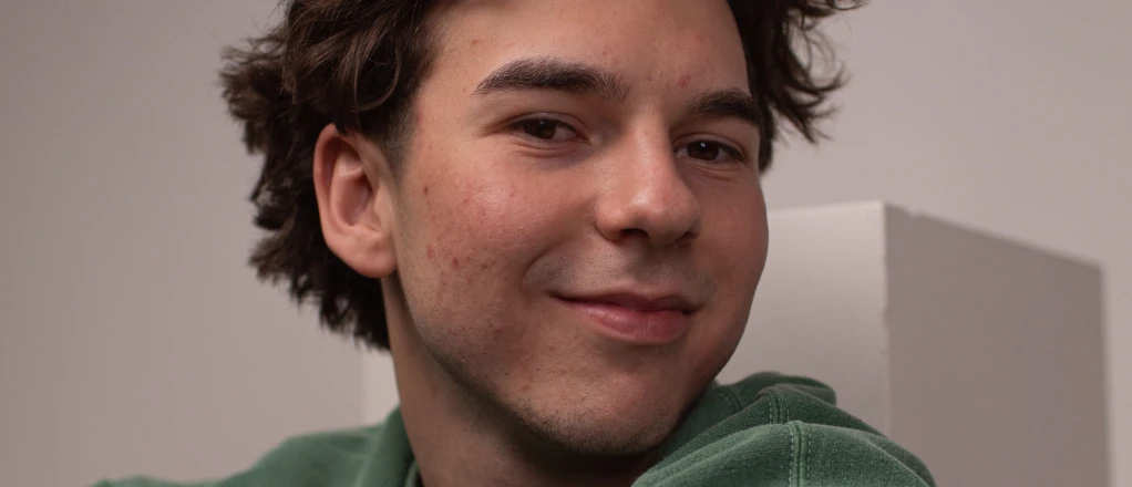 blemish-removal-before