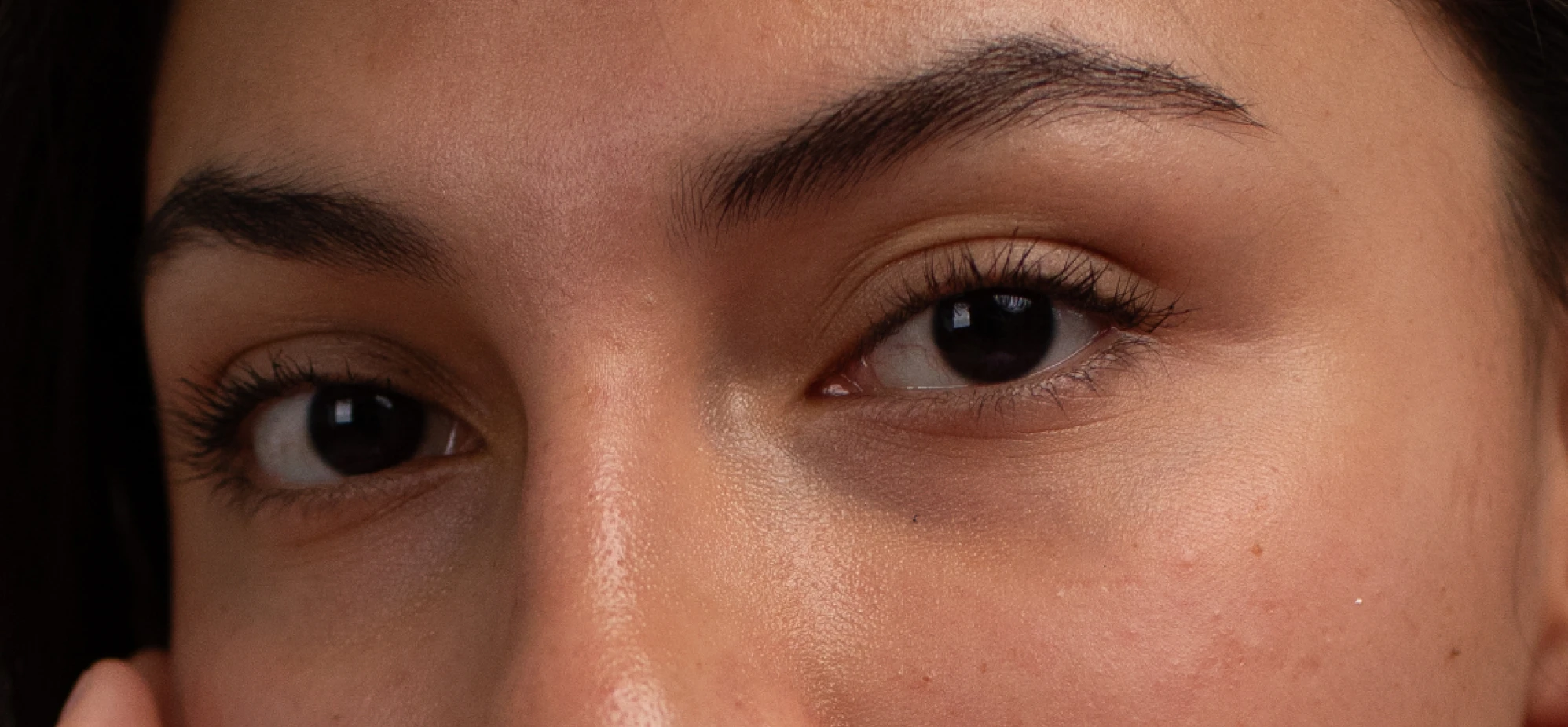 eye-brightness-before