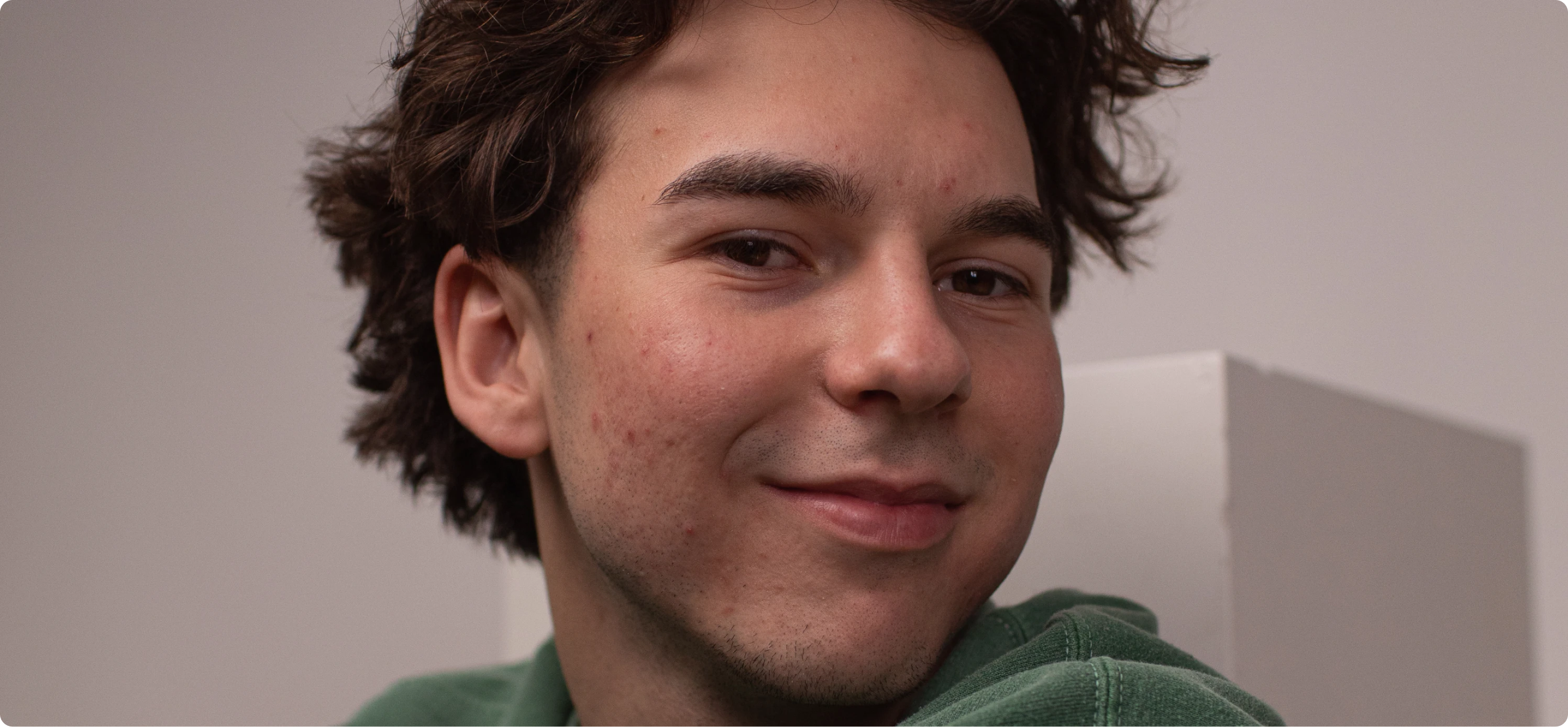 blemish removal before